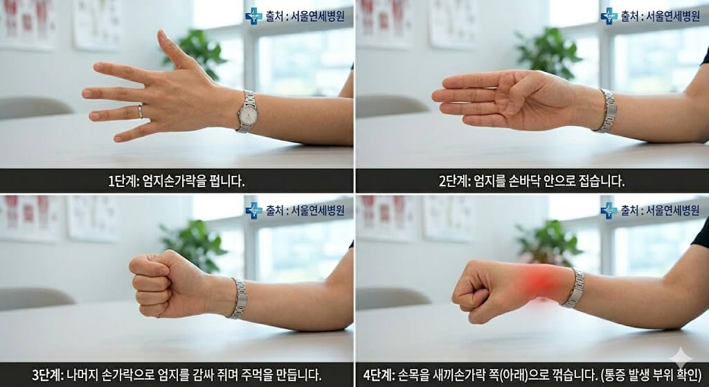 지독한 손목 통증, 엄지손가락 건초염(드퀘르벵) 원인부터 완치까지